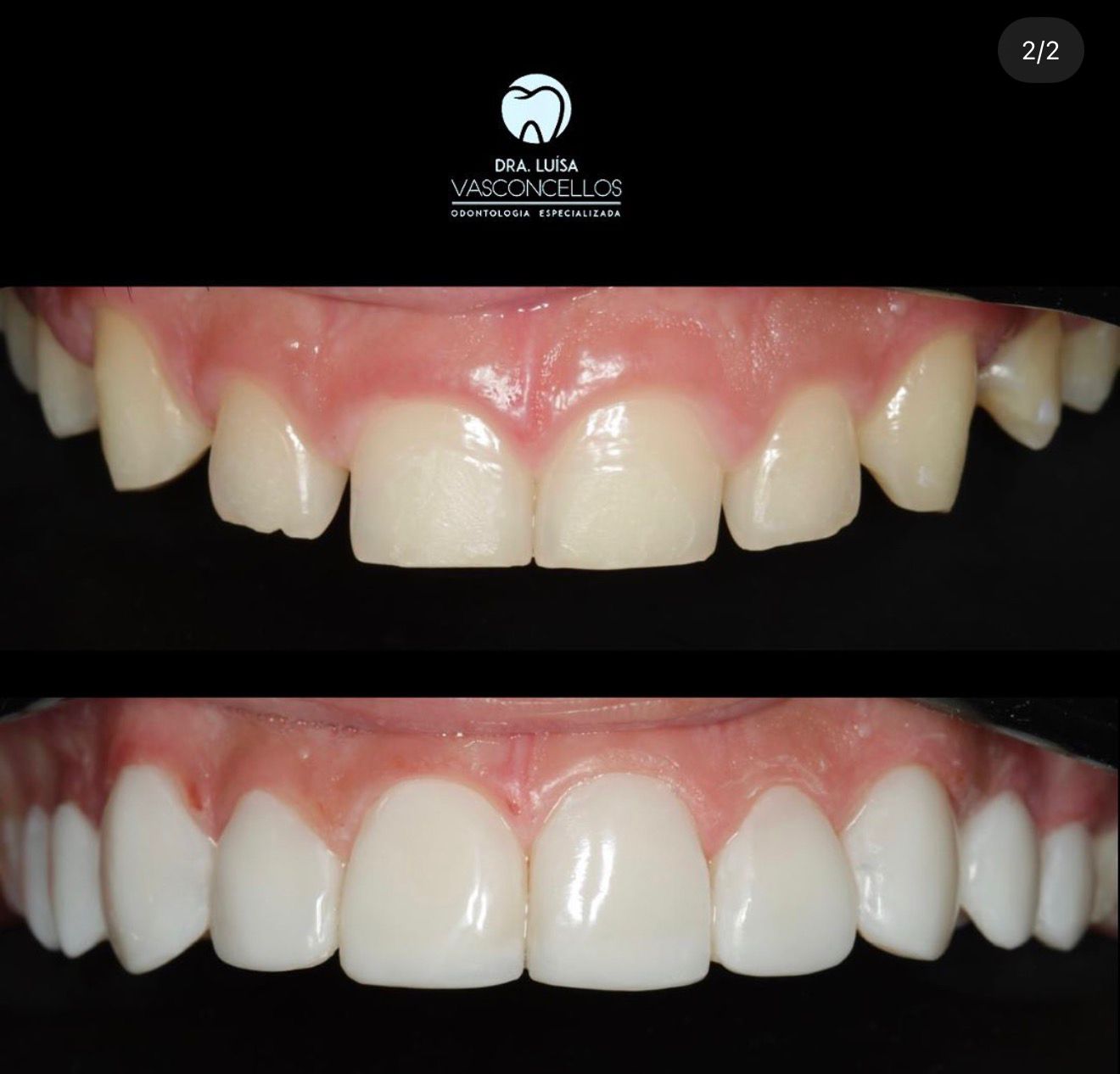 Dentística